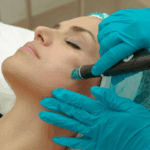 Diodenlaser Haarentfernung